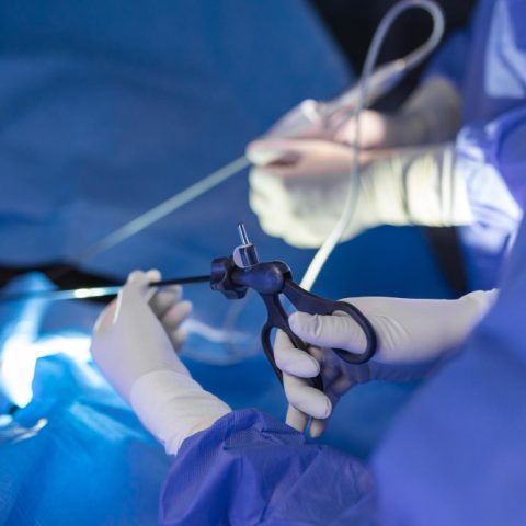 Arthroscopy Minimally Invasive Surgery