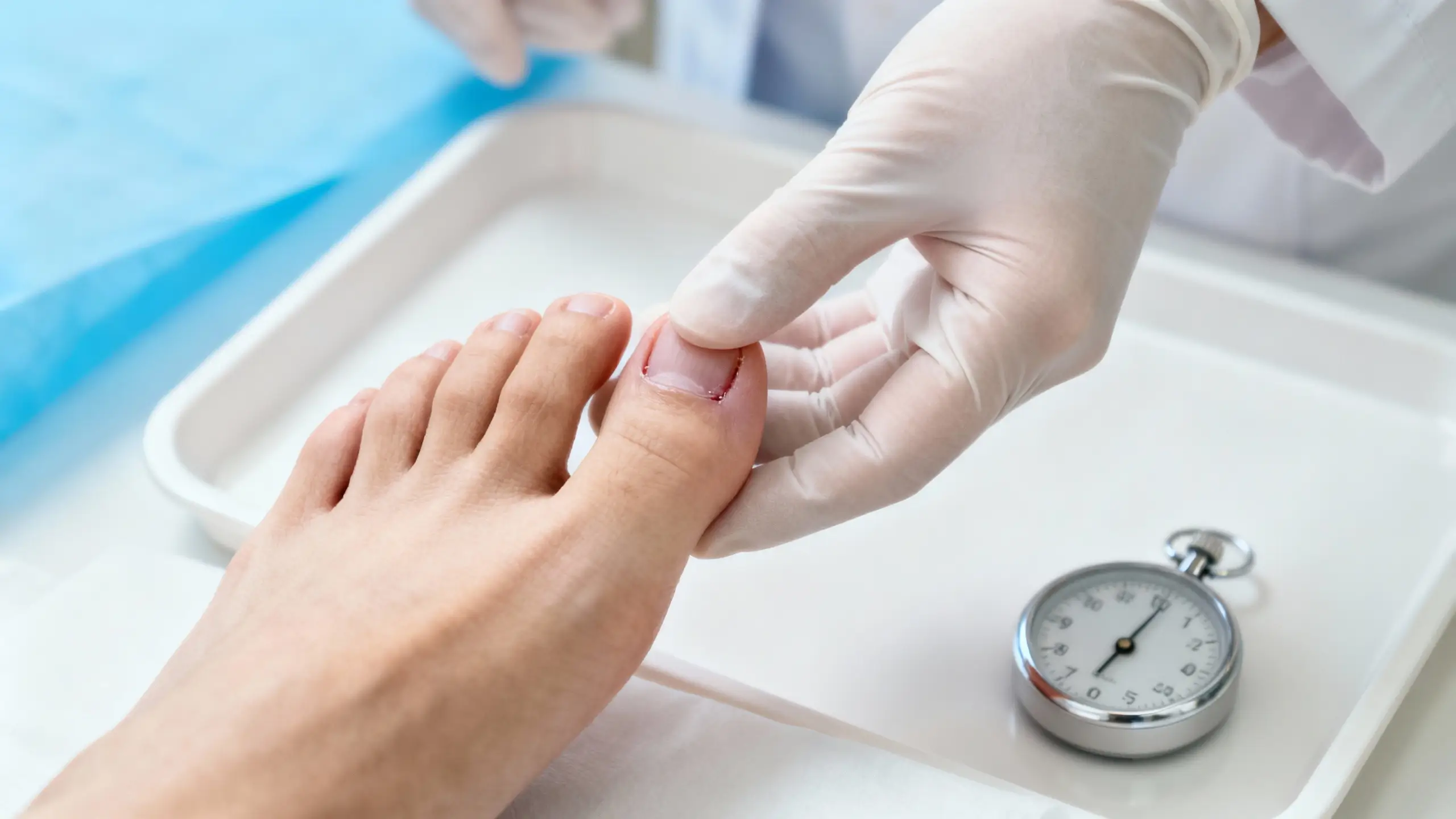 Foot Gangrene Foot Gangrene