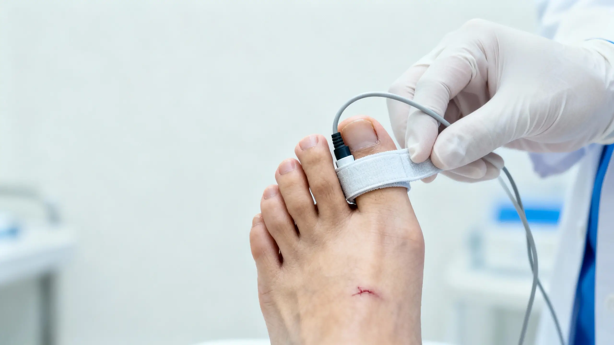 Ischaemic Foot Ulcers Ischemic Foot Ulcers